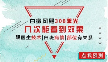 白癜风308治疗仪价格贵不贵 按面积收费吗