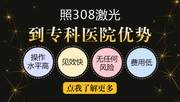 308激光照白癜风是不是很贵 多少钱照一次