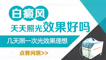 白癜风治疗仪多久照一次 白斑照光多少钱