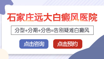 两个眼角长了白癜风用什么方法能治好