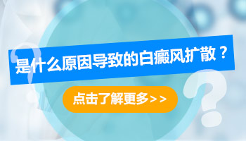 白癜风照了UVB以后扩散了怎么回事