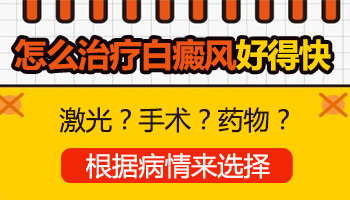 鼻子两侧白癜风怎么治疗好