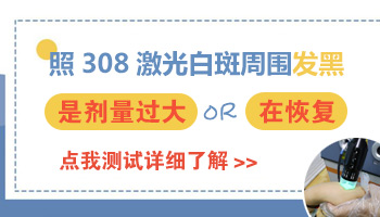 白癜风照光剂量大会不会再次扩散