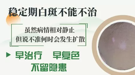 白癜风几年没变化还用治疗吗