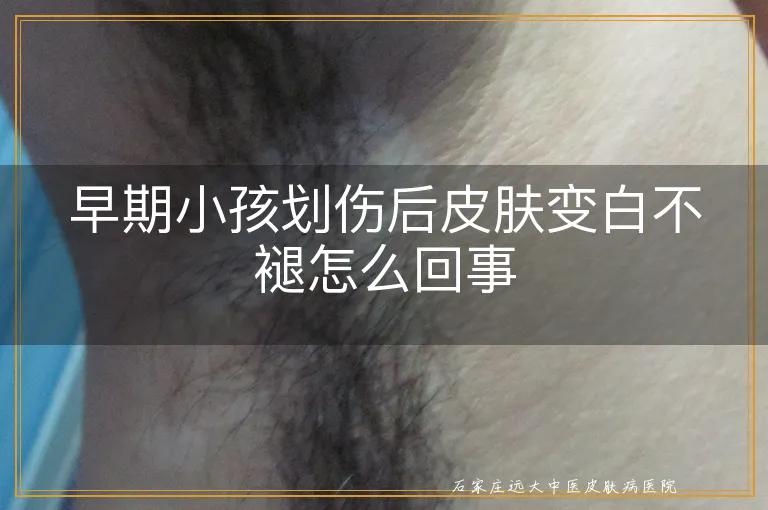 早期小孩划伤后皮肤变白不褪怎么回事