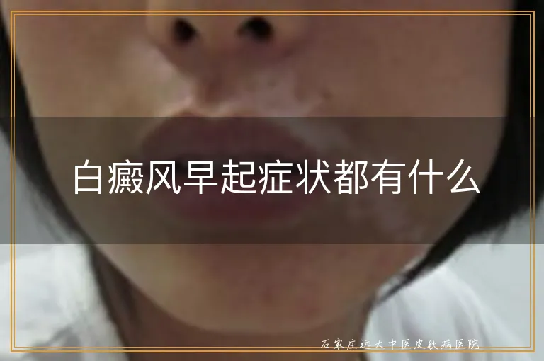 白癜风早起症状都有什么