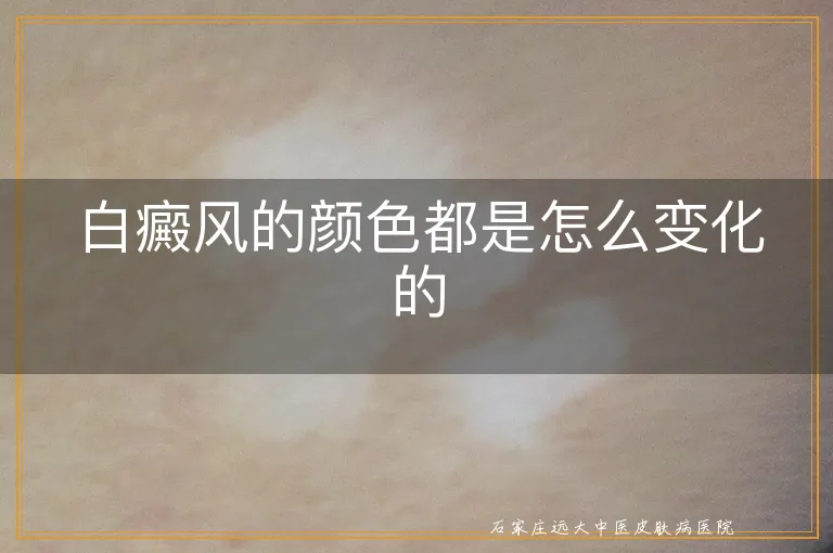 白癜风的颜色都是怎么变化的