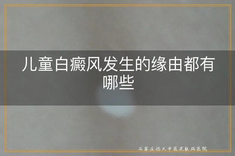 儿童白癜风发生的缘由都有哪些