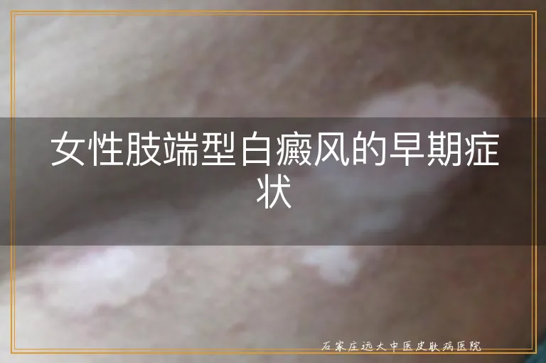 女性肢端型白癜风的早期症状