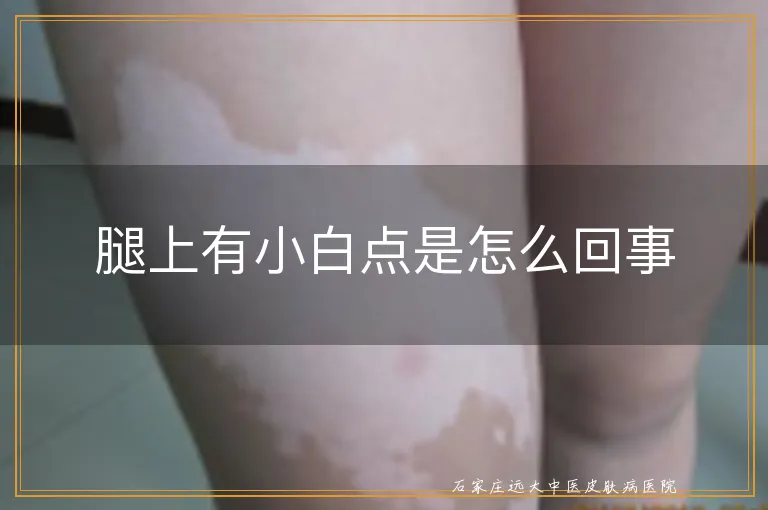 腿上有小白点是怎么回事