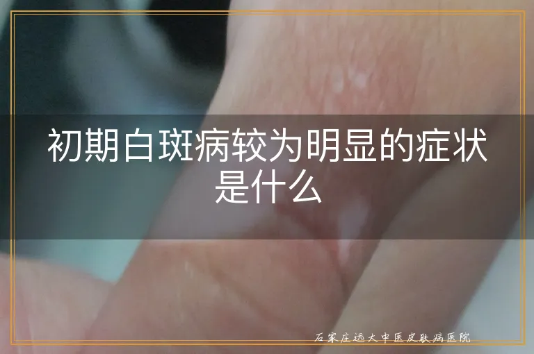 初期白斑病较为明显的症状是什么