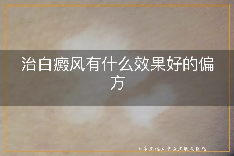 治白癜风有什么效果好的偏方