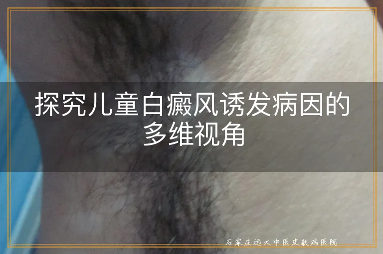 探究儿童白癜风诱发病因的多维视角