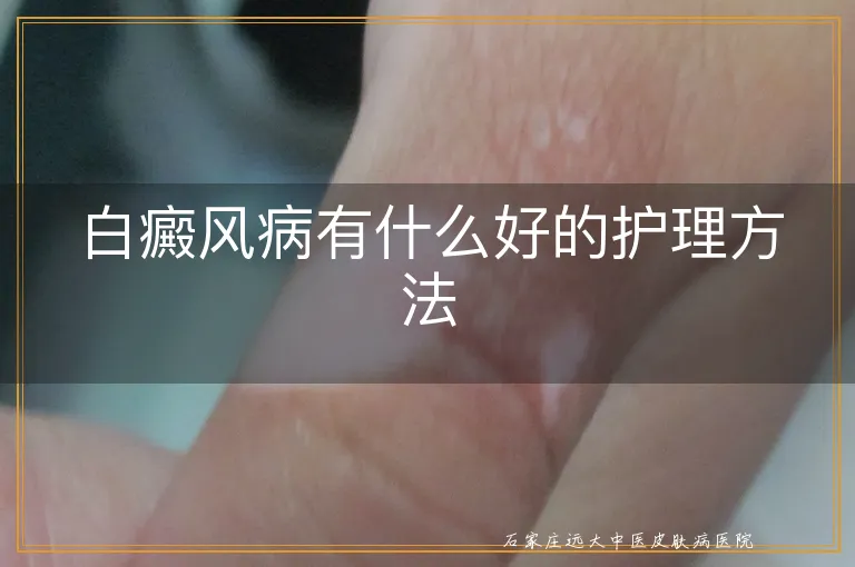 白癜风病有什么好的护理方法