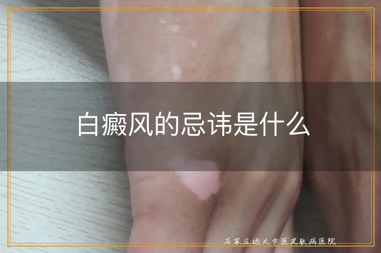 白癜风的忌讳是什么