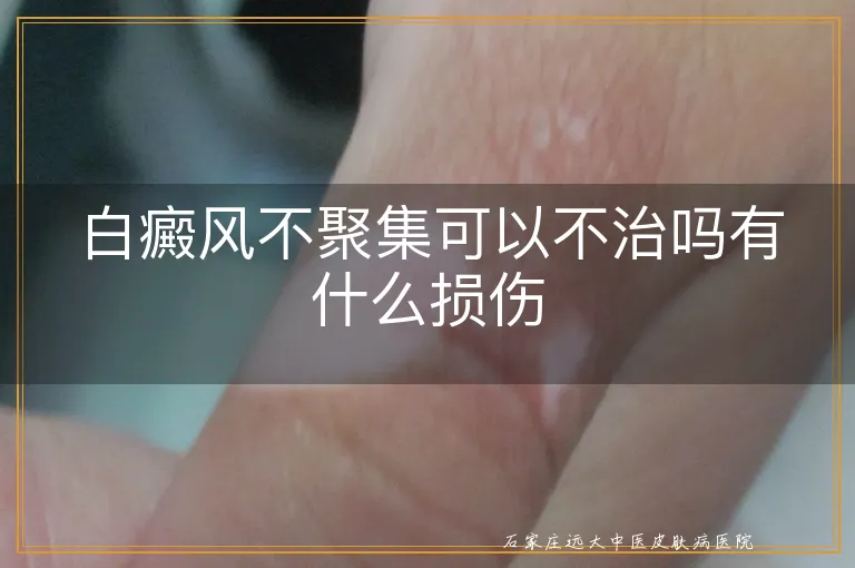 白癜风不聚集可以不治吗有什么损伤