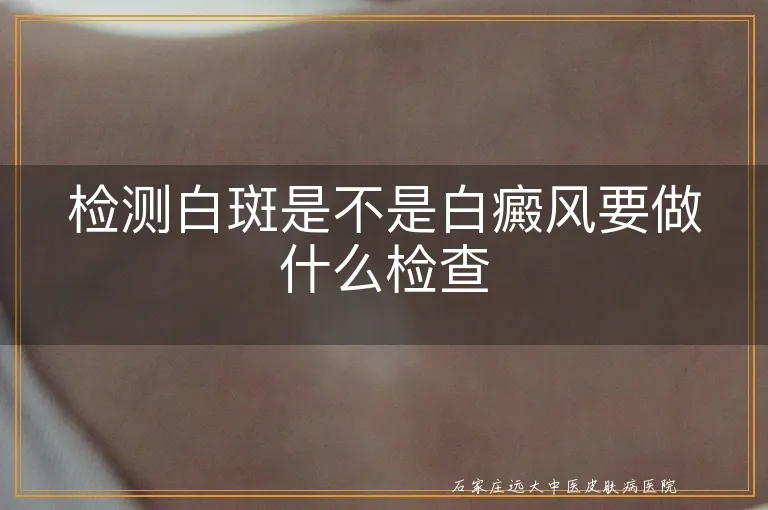 检测白斑是不是白癜风要做什么检查