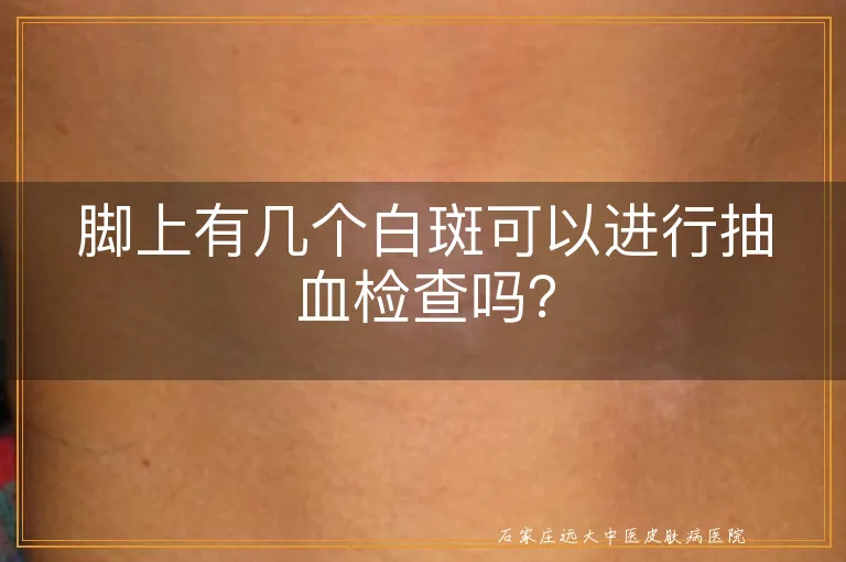 脚上有几个白斑可以进行抽血检查吗？