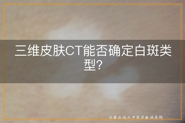 三维皮肤CT能否确定白斑类型？