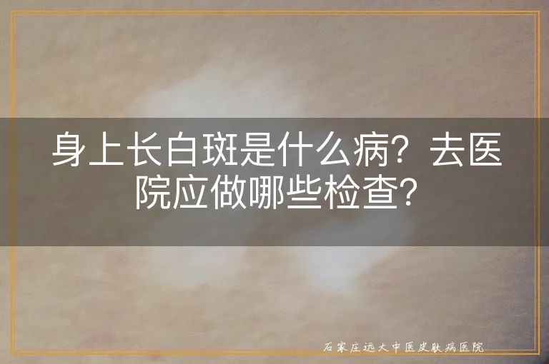 身上长白斑是什么病？去医院应做哪些检查？