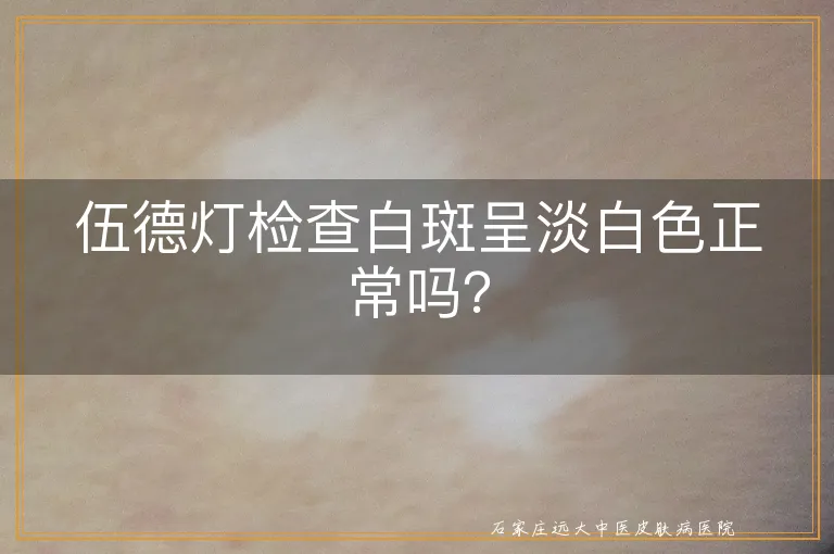 伍德灯检查白斑呈淡白色正常吗？