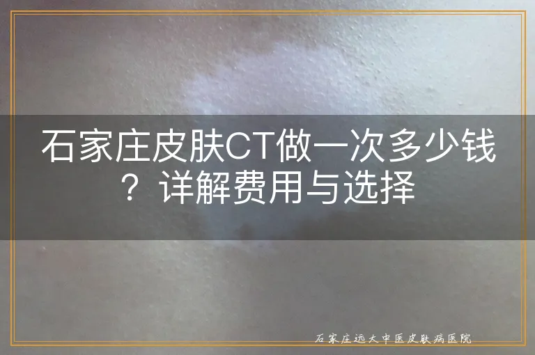 石家庄皮肤CT做一次多少钱？详解费用与选择