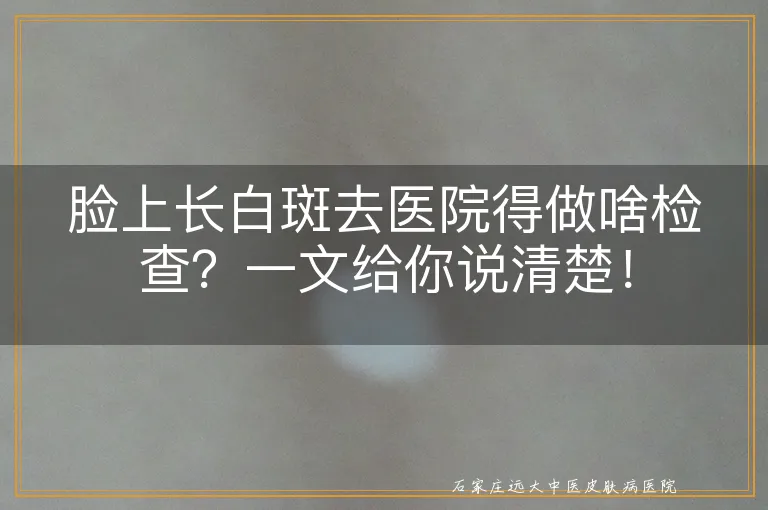 脸上长白斑去医院得做啥检查？一文给你说清楚！