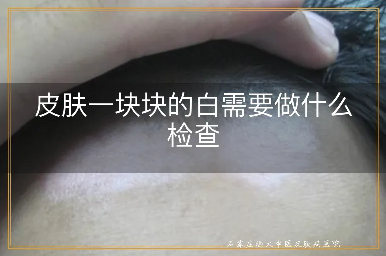 皮肤一块块的白需要做什么检查