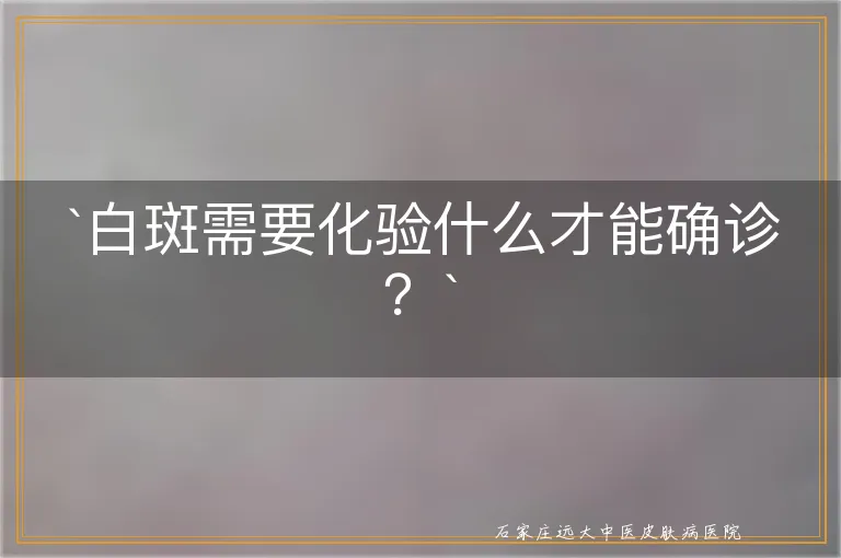 `白斑需要化验什么才能确诊？`