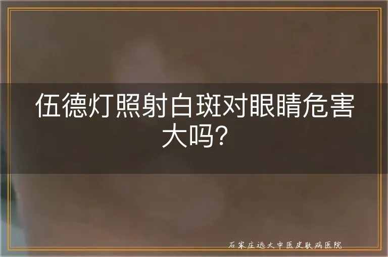 伍德灯照射白斑对眼睛危害大吗？