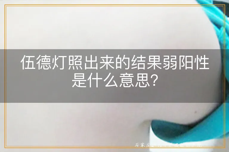 伍德灯照出来的结果弱阳性是什么意思？