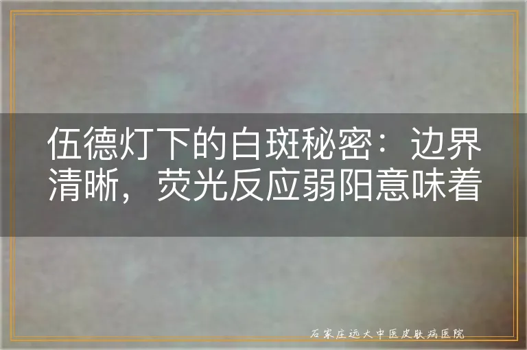 伍德灯下的白斑秘密：边界清晰，荧光反应弱阳意味着什么？