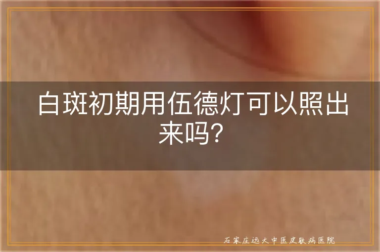 白斑初期用伍德灯可以照出来吗？