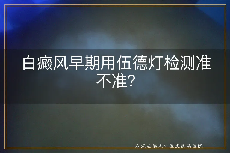 白癜风早期用伍德灯检测准不准？