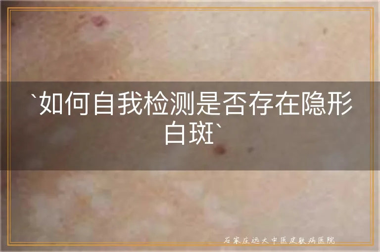 `如何自我检测是否存在隐形白斑`