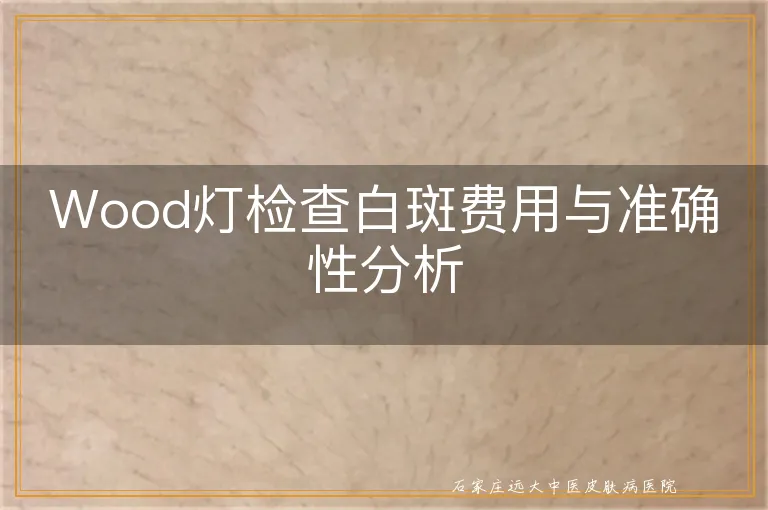 Wood灯检查白斑费用与准确性分析