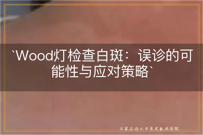 `Wood灯检查白斑：误诊的可能性与应对策略`