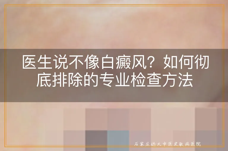 医生说不像白癜风？如何彻底排除的专业检查方法