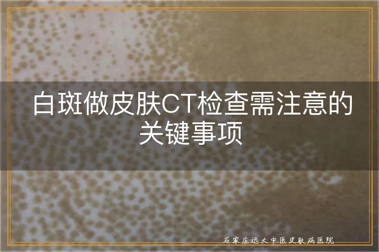 白斑做皮肤CT检查需注意的关键事项