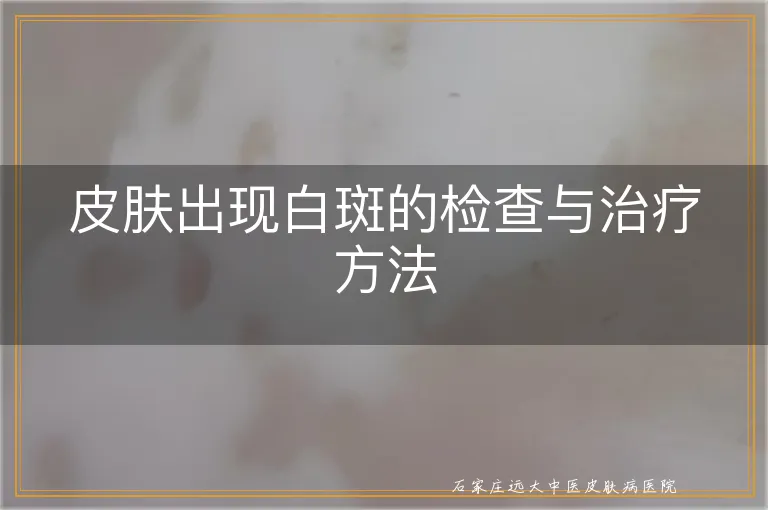 皮肤出现白斑的检查与治疗方法