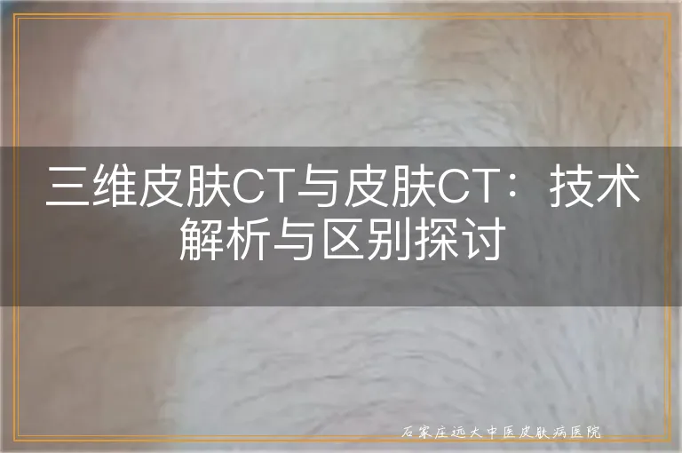 三维皮肤CT与皮肤CT：技术解析与区别探讨