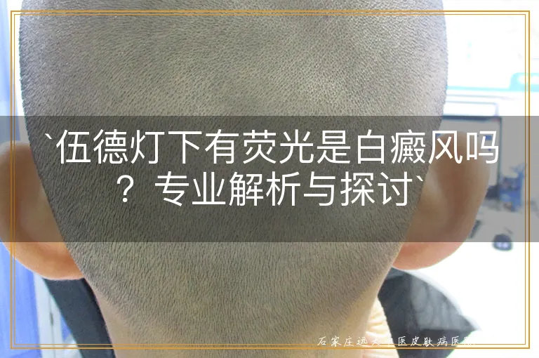 `伍德灯下有荧光是白癜风吗？专业解析与探讨`