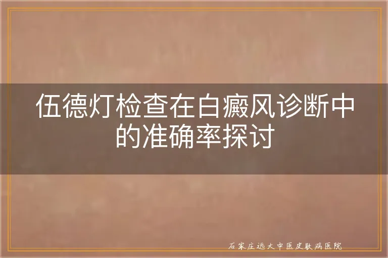 伍德灯检查在白癜风诊断中的准确率探讨