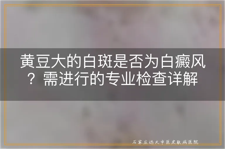 黄豆大的白斑是否为白癜风？需进行的专业检查详解