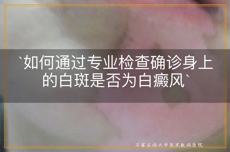 `如何通过专业检查确诊身上的白斑是否为白癜风`