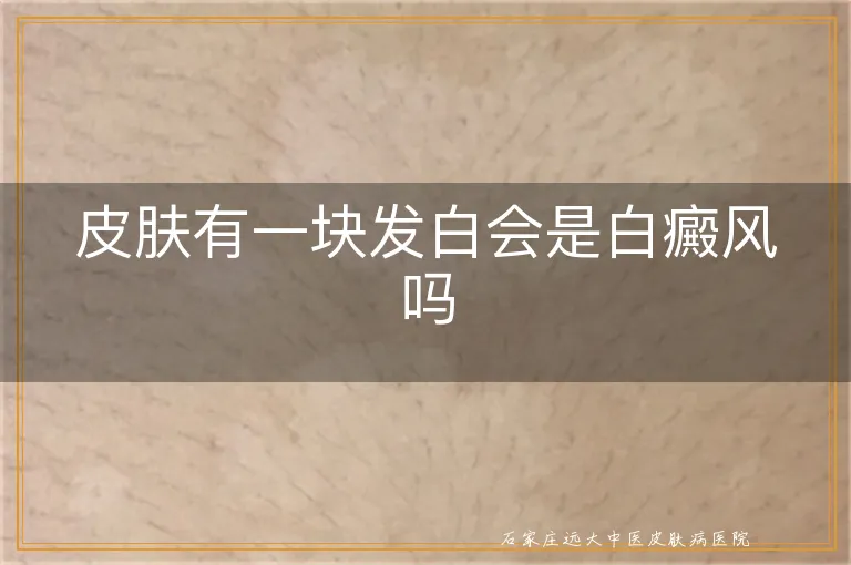 皮肤有一块发白会是白癜风吗