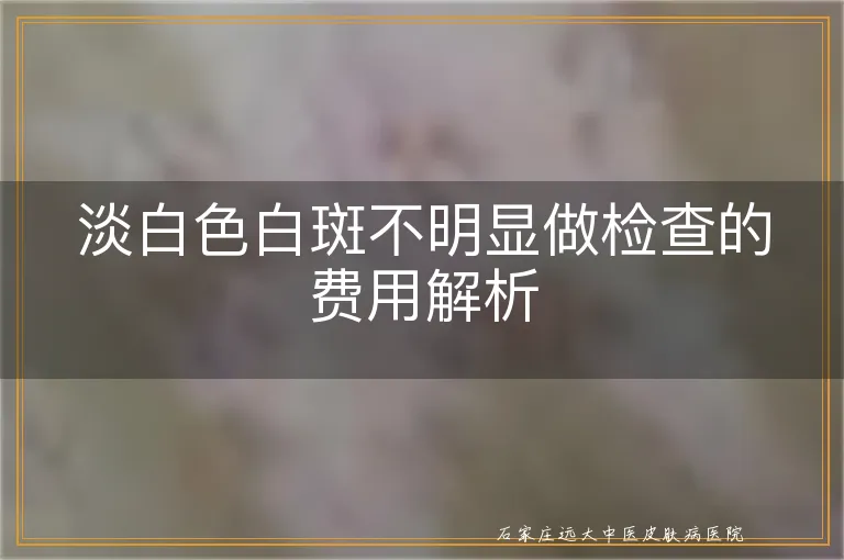 淡白色白斑不明显做检查的费用解析