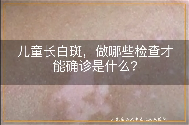 儿童长白斑，做哪些检查才能确诊是什么？