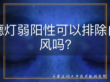 伍德灯弱阳性可以排除白癜风吗？