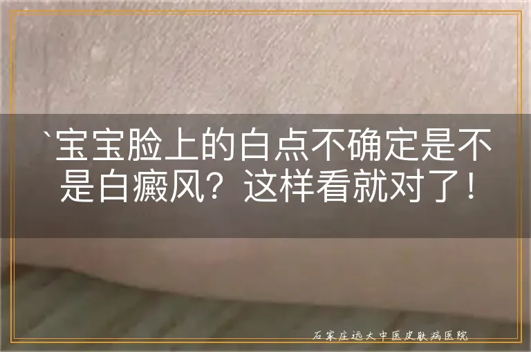 `宝宝脸上的白点不确定是不是白癜风？这样看就对了！`